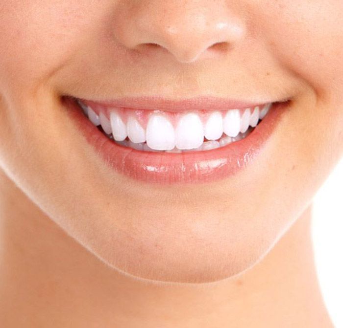 Zahn-Bleaching für ein schönes Lächeln