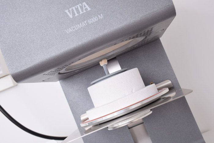 Implantatversorgung Implantatversorgung