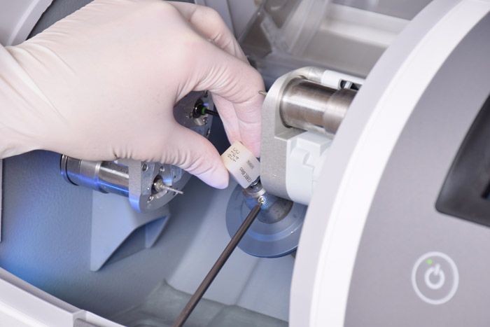 Implantatversorgung Implantatversorgung